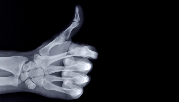 gallery/xraythumbup